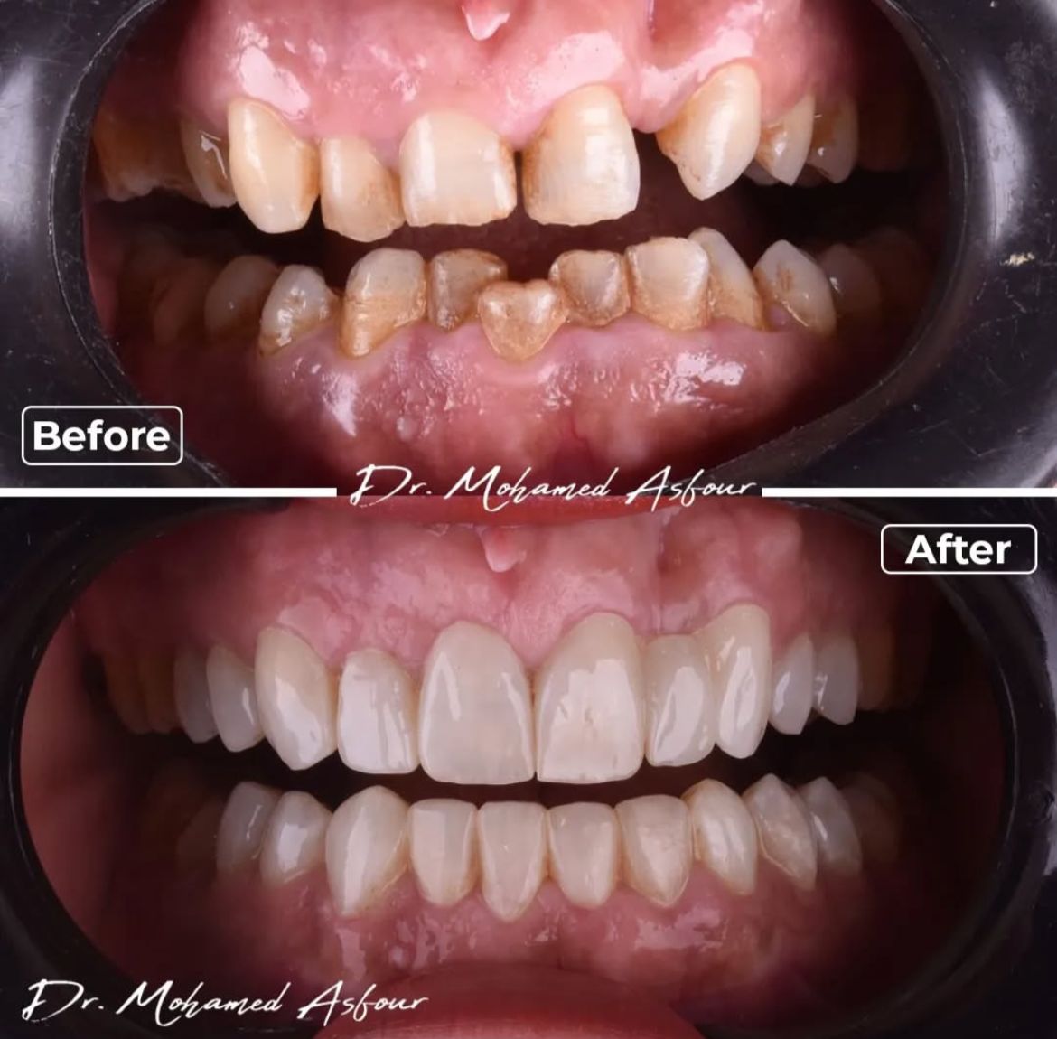 التجميل